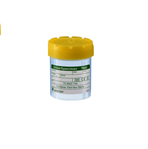 Specimen Sample Container, Urine Jar, 70ml, Sterile